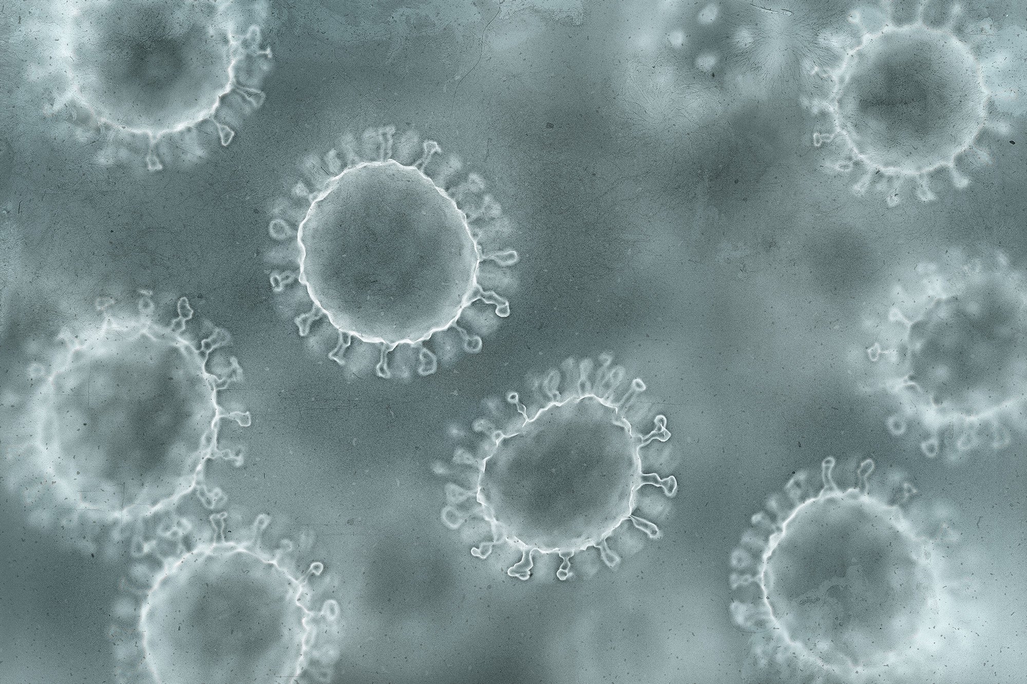 Flu Subtyping Panel: H1, H3, H5 Detection Assay