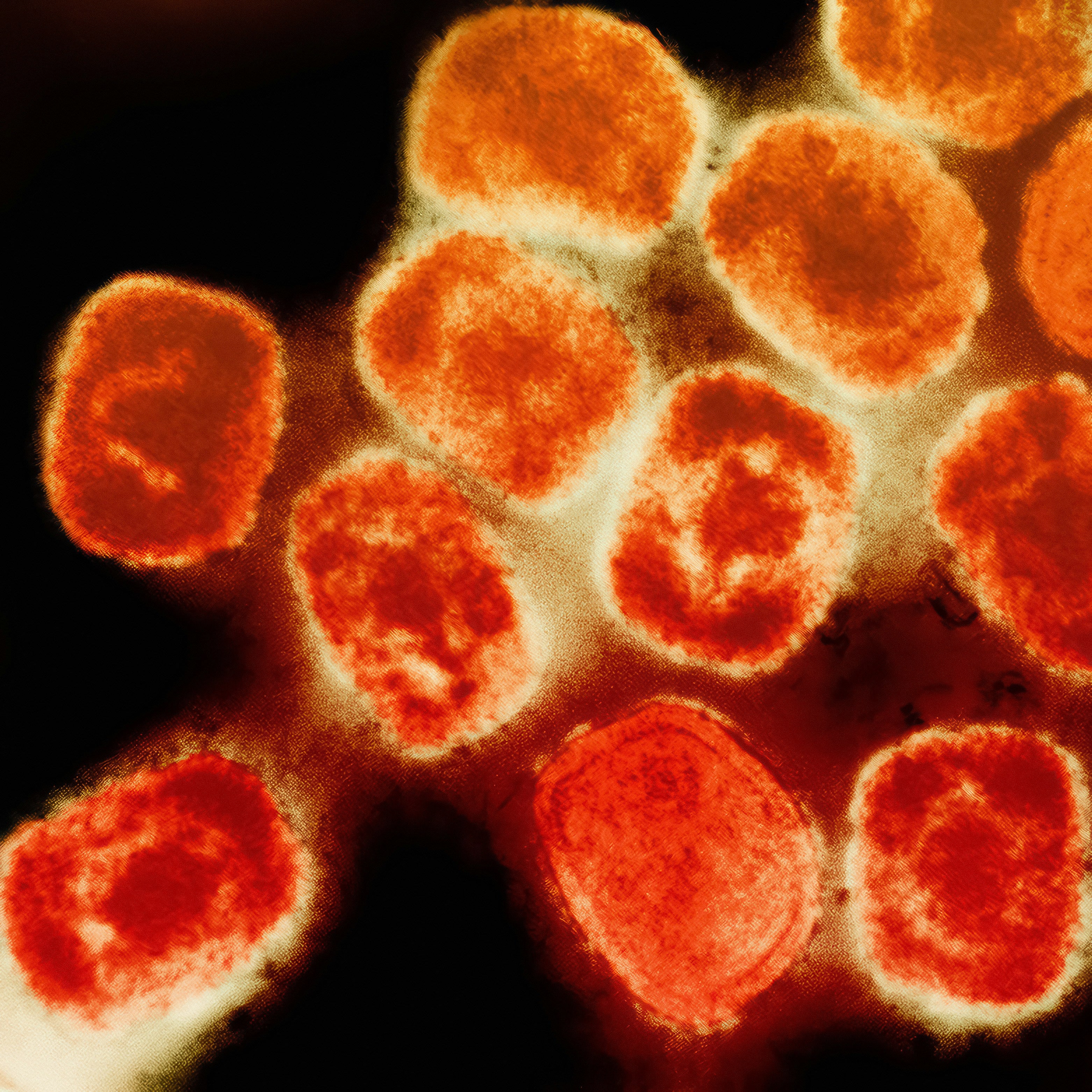 Monkeypox Virus Multiplex Detection Assay (Clade Ia, Pan-Clade I, and Clade II)