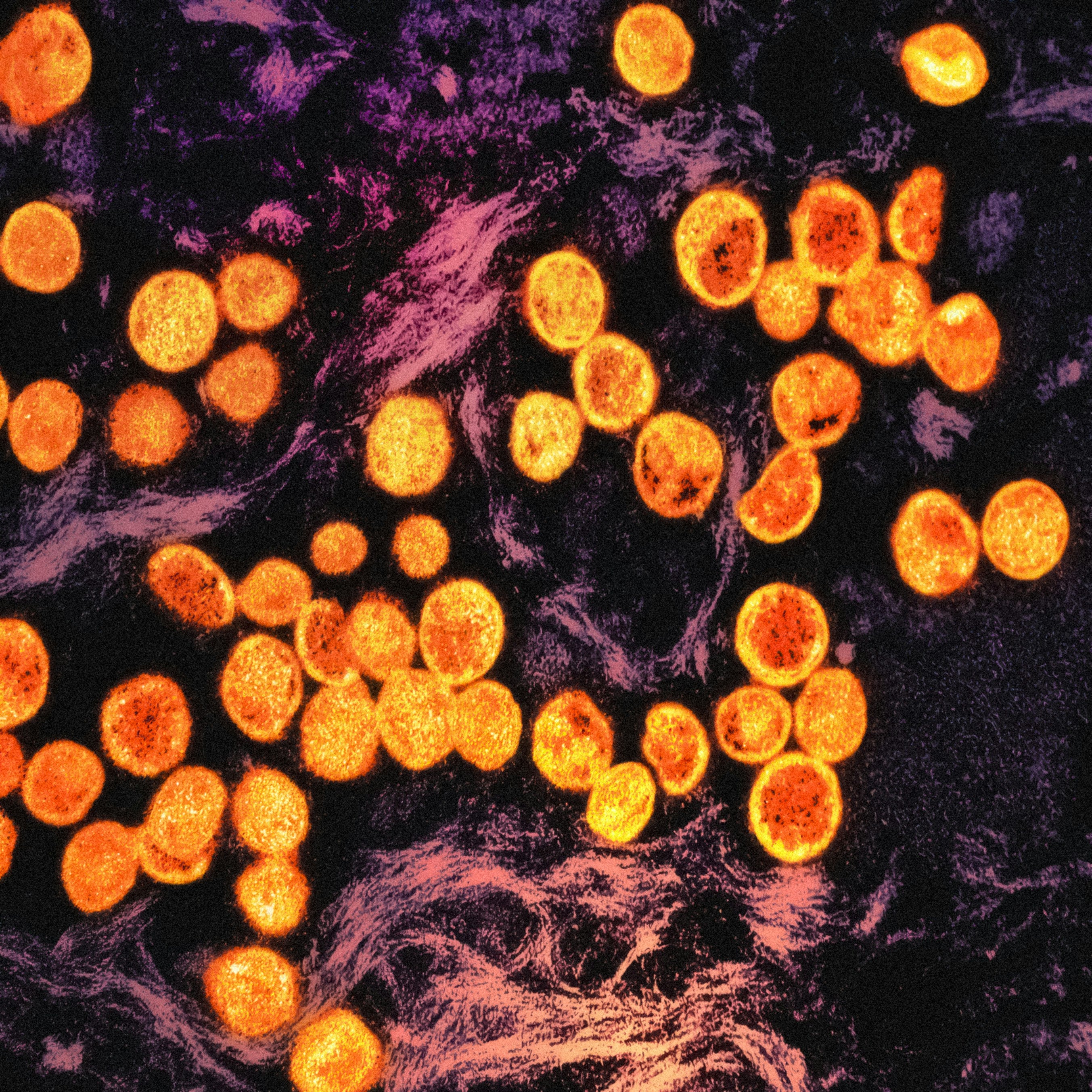 Monkeypox Virus Pan-Clade I Detection Assay